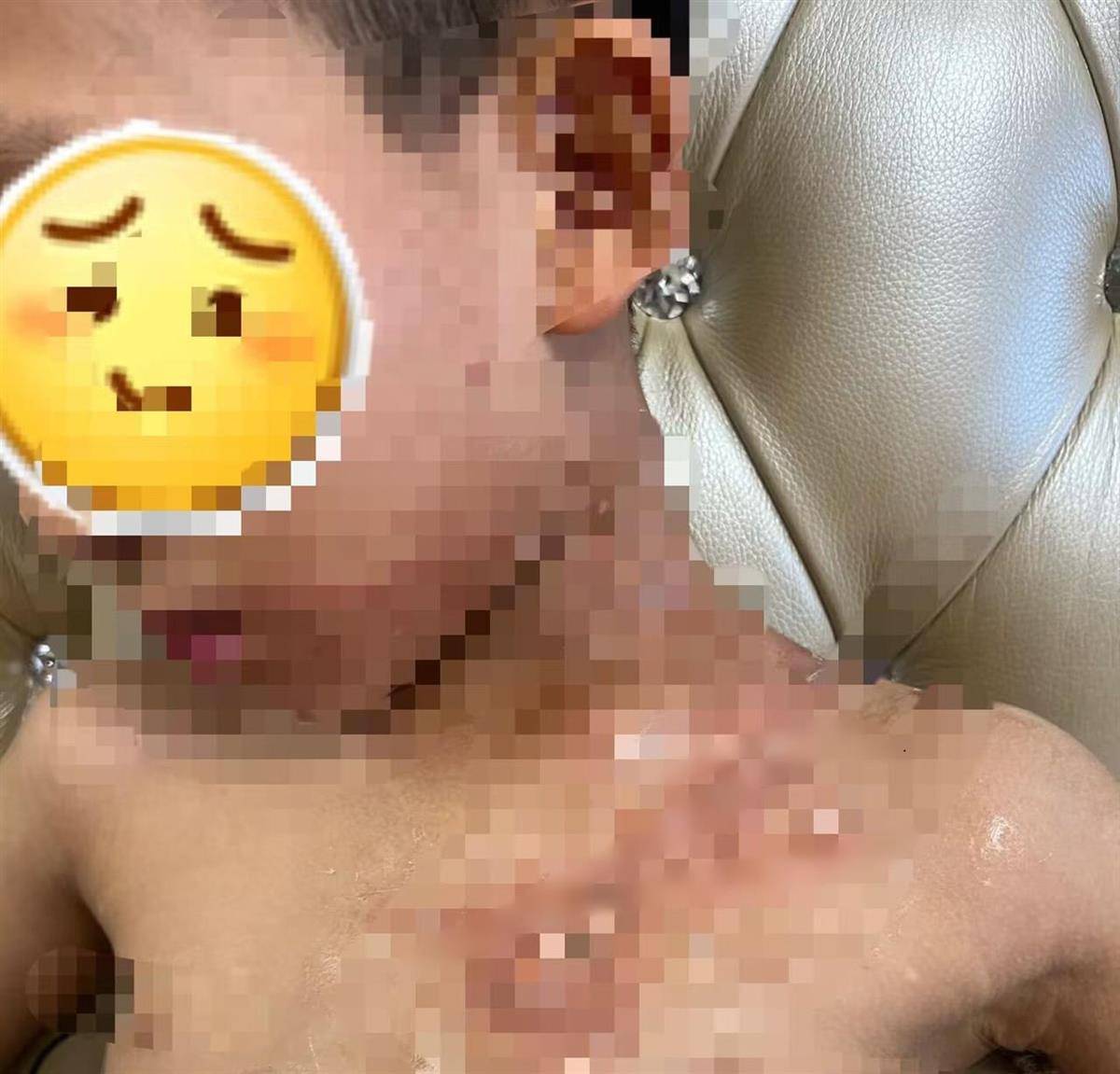 餐厅服务员端着酸菜鱼“追尾”撞上男孩，致其被热汤烫伤胸口，合肥警方介入